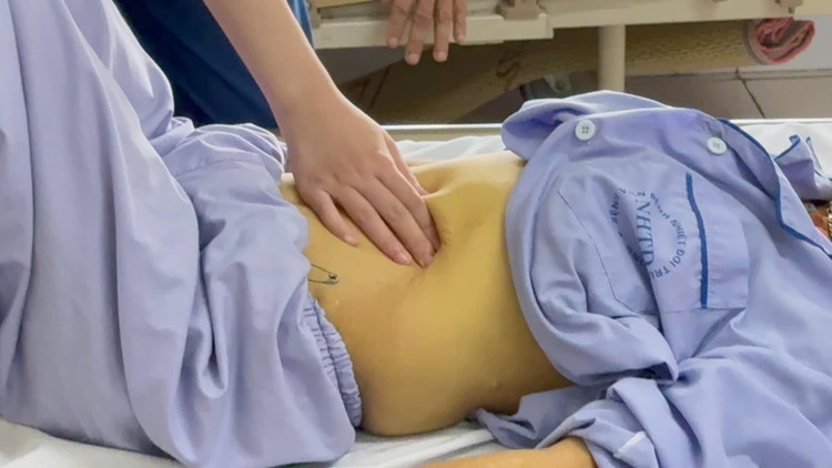 Hình ảnh vàng da ở bệnh nhân viêm gan nhiễm độc cấp. Ảnh BVCC