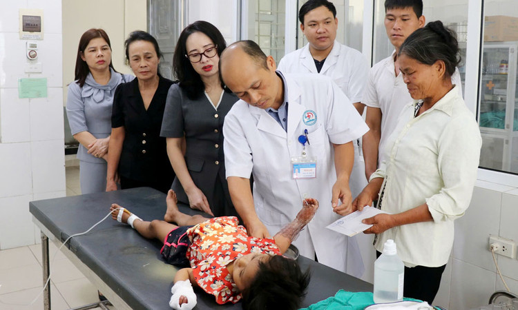 Tay của bệnh nhi bị nhiễm trùng, bỏng độ 3 - Ảnh: Báo Bắc Giang