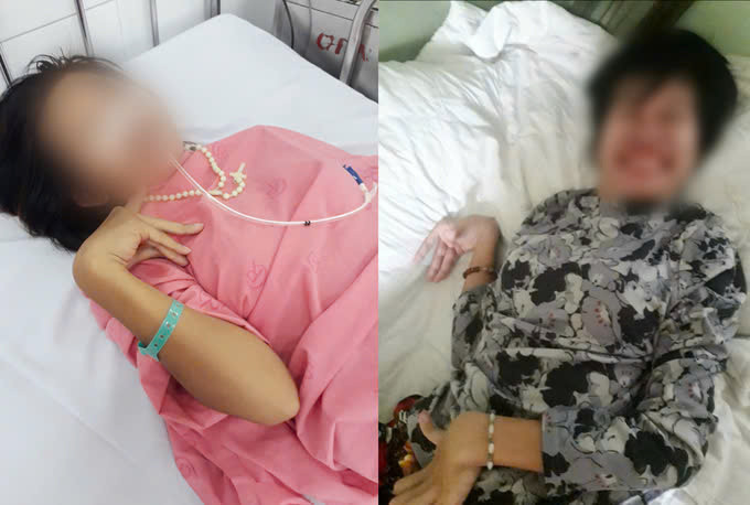 Cô gái mắc bệnh hiếm gặp vừa được Bệnh viện Chợ Rẫy điều trị thành công. Ảnh BVCC