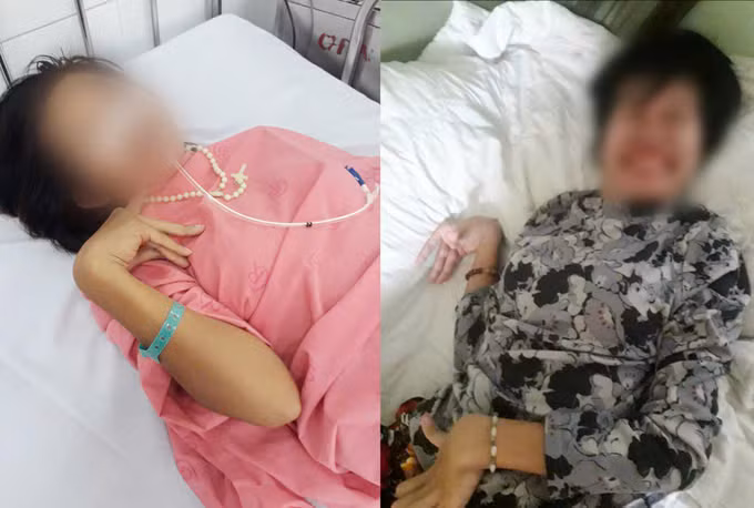 Cô gái mắc bệnh hiếm gặp vừa được Bệnh viện Chợ Rẫy điều trị thành công. Ảnh BVCC