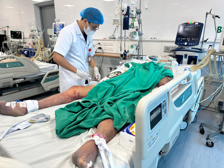 Bệnh nhân nhiễm khuẩn huyết, viêm màng não theo dõi do liên cầu lợn sau ăn tiết canh. Ảnh BVCC