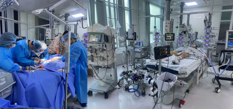 Cứu sống thành công bé gái bị viêm cơ tim tối cấp. Ảnh Bệnh viện Nhi Đồng Thành Phố