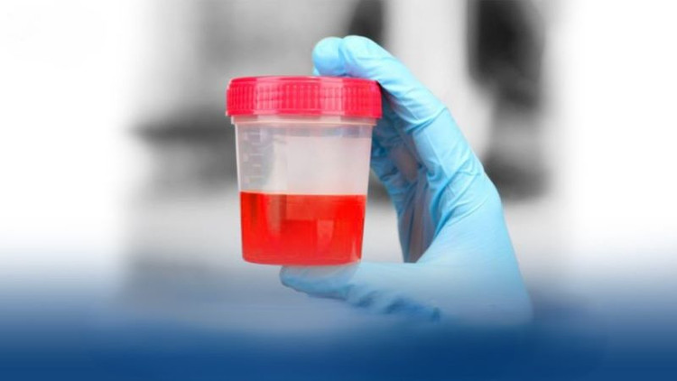 Ảnh minh họa Ảnh minh họa