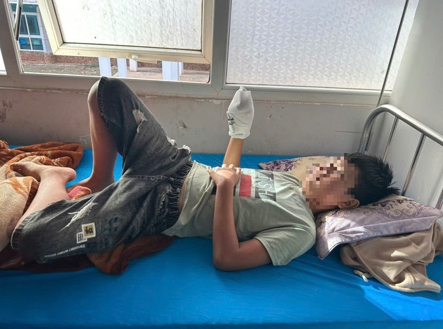 Một học sinh bị thương do pháo nổ gây ra. Một học sinh bị thương do pháo nổ gây ra.