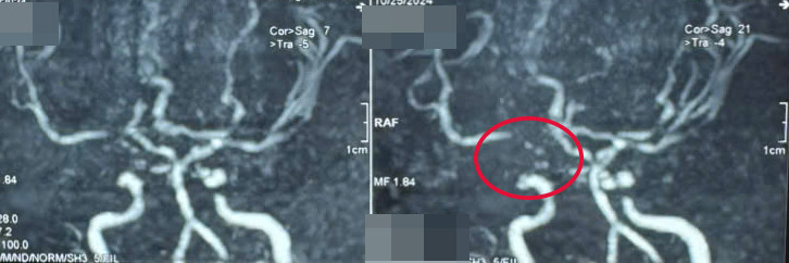 Hình ảnh trước và sau can thiệp - Ảnh: BVCC