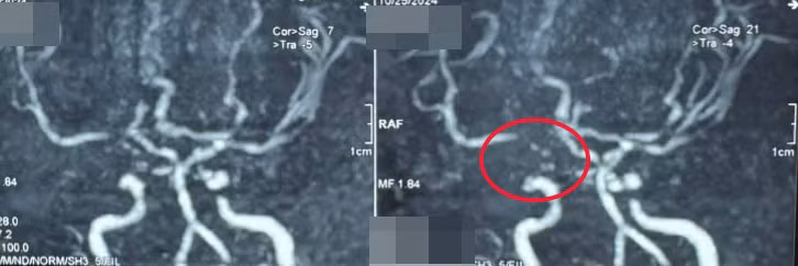 Hình ảnh trước và sau can thiệp - Ảnh: BVCC