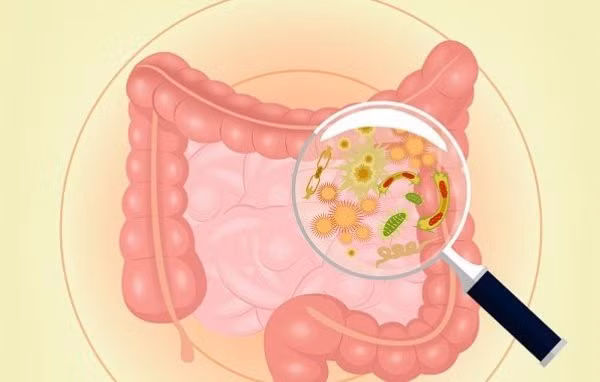 Dấu hiệu cảnh báo đường ruột cực "bẩn", cần cải thiện ngay. Ảnh minh họa