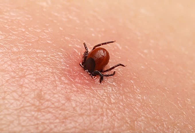 Bệnh sốt mò: Phát hiện muộn có thể dẫn đến tử vong. Ảnh minh họa