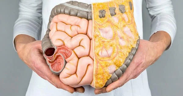 Cách &quot;đào thải&quot; mỡ nội tạng ở người trung niên. Ảnh minh họa