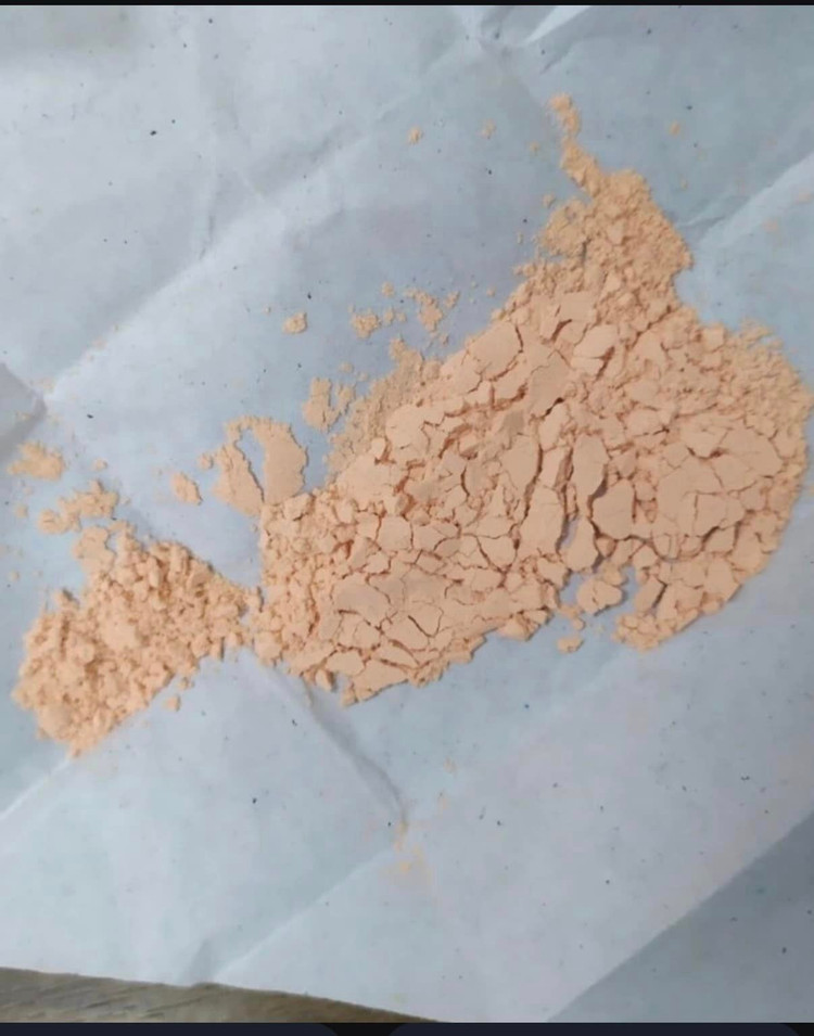 Điều trị nấm miệng bằng &quot;thuốc cam&quot; trong vòng 1 tuần, bé trai phải thở máy, lọc máu liên tục. Ảnh BVCC