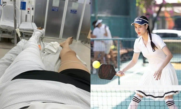 Người mẫu Kỳ Hân gặp chấn thương nặng ở chân khi chơi pickleball.