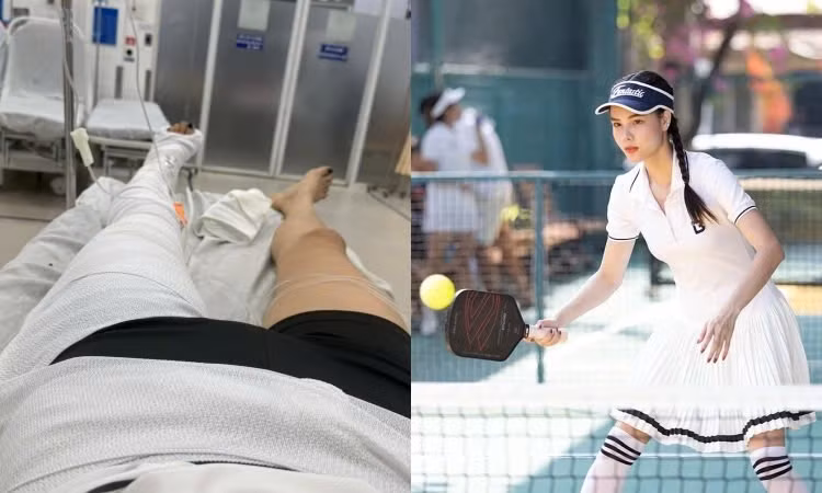 Người mẫu Kỳ Hân gặp chấn thương nặng ở chân khi chơi pickleball.