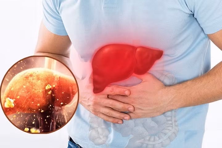 Cảnh báo 5 thói quen tàn phá gan vào mùa lạnh ảnh 1