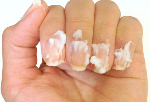 Ảnh minh họa Ảnh minh họa