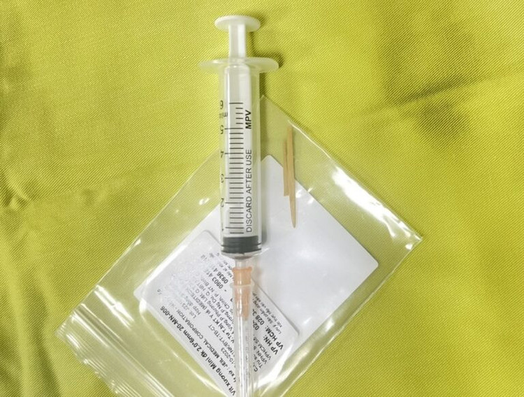 Nam thanh niên 17 tuổi thủng đại tràng do nuốt tăm tre. Ảnh BVCC