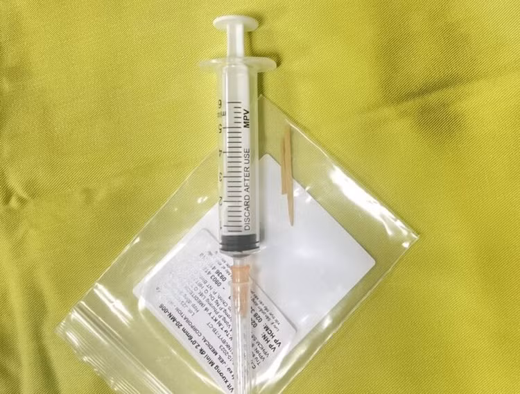 Nam thanh niên 17 tuổi thủng đại tràng do nuốt tăm tre. Ảnh BVCC