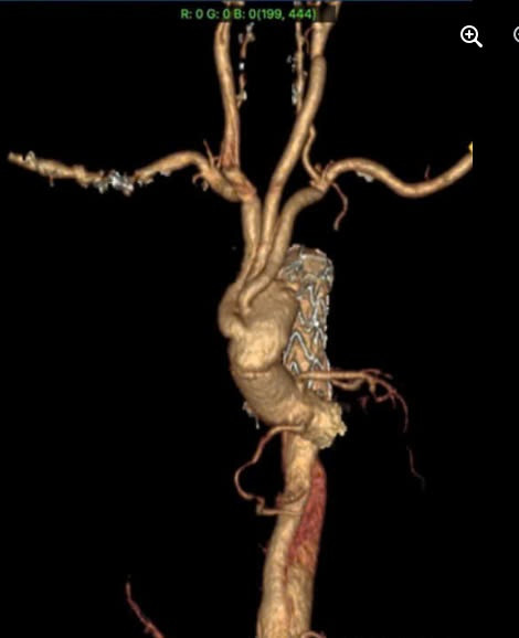 Hình ảnh sau mổ. Ảnh BVCC