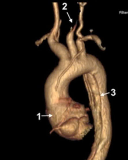 Hình ảnh trước mổ. Ảnh BVCC