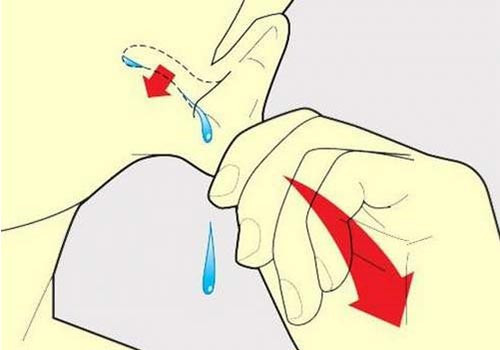 Mẹo xử trí khi bị nước vào tai an toàn, không gây nhiễm trùng. Ảnh minh họa