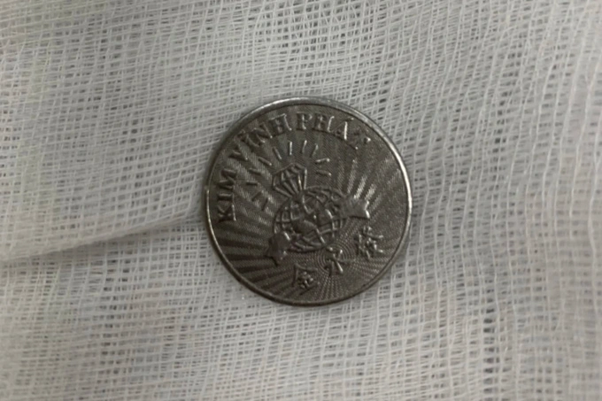 Đồng xu được lấy từ thực quản cháu bé. Ảnh dantri