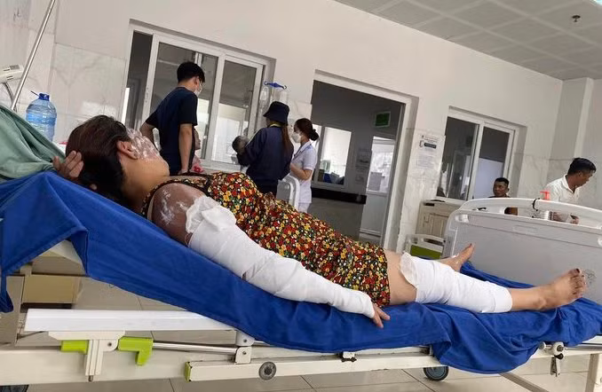 Bệnh nhân trong vụ nổ nhập viện với nhiều vết bỏng trên cơ thể. Bệnh nhân trong vụ nổ nhập viện với nhiều vết bỏng trên cơ thể.