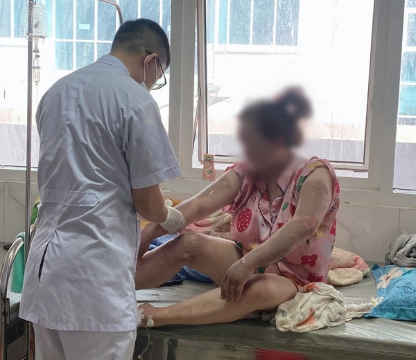 Ảnh 1: Vụ nổ bình gas mini khiến 7 người ở xã Ea Tiêu, huyện Cư Kuin, tỉnh Đắk Lắk bị bỏng, phải nhập viện cấp cứu. Ảnh: Báo Đắk Lắk