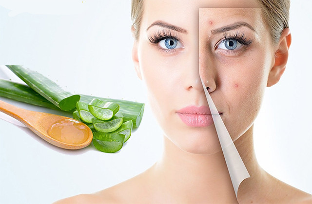 Nha đam tươi trị mụn rối loạn nội tiết. Ảnh minh họa Nha đam tươi trị mụn rối loạn nội tiết. Ảnh minh họa