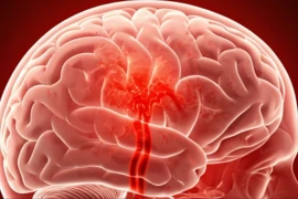 6 loại thực phẩm giúp não 'dễ thở', giảm hoa mắt, chóng mặt