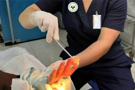 Tắc kè cắn người phụ nữ 28 tuổi phải nhập viện