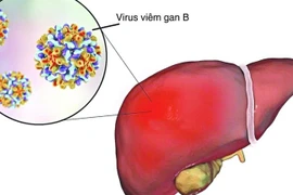 Viêm gan siêu vi B - kẻ giết người thầm lặng 