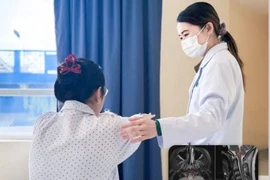 Buồn nôn nấc cụt, tưởng rối loạn tiêu hóa không ngờ viêm tủy thị thần kinh