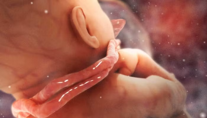 Vòng hoa quấn cổ là tình trạng dây rốn quấn quanh cổ thai nhi một vòng hay nhiều vòng - Ảnh minh hoạ