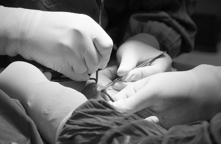 Các bác sĩ phẫu thuật cho bệnh nhân ở Phú Thọ - Ảnh: BVCC.