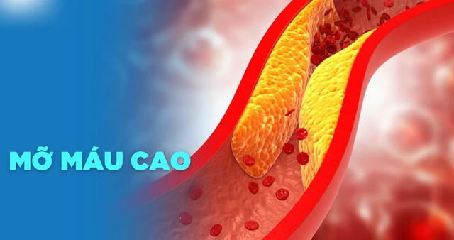 Tăng cholesterol máu không chỉ gây ra xơ vữa mạch, nhồi máu cơ tim, tai biến mạch máu não…có thể dẫn đến tử vong mà còn ảnh hưởng đến đời sống tình dục ở cả nam và nữ.