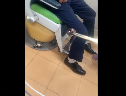 Con đỉa rừng được gắp ra từ mũi người đàn ông - Ảnh cắt từ video Trung tâm Y tế huyện Tiên Yên