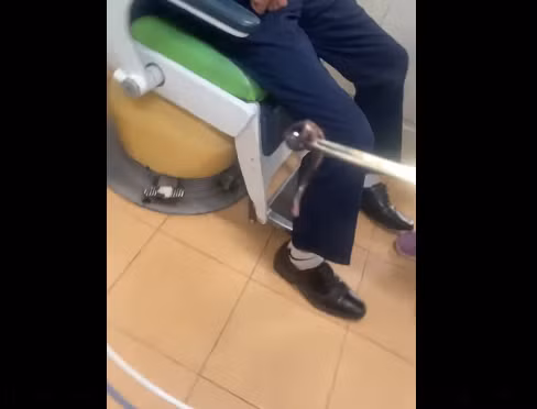 Con đỉa rừng được gắp ra từ mũi người đàn ông - Ảnh cắt từ video Trung tâm Y tế huyện Tiên Yên