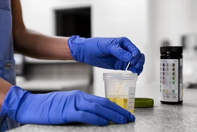 Ở trạng thái bình thường, nước tiểu có màu vàng nhạt. Ảnh: Freepik.