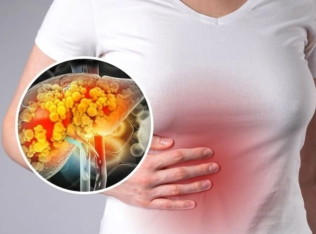 Nhiều loại lá dễ tìm ở Việt Nam có thể hỗ trợ điều trị gan nhiễm mỡ. Ảnh: Health Site