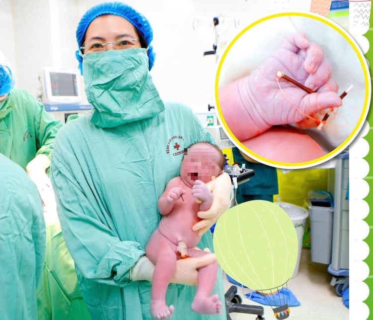 Bé trai chào đời cùng với vòng tránh thai của mẹ - Ảnh BSCC