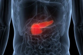 Cứu sống bệnh nhân trẻ nguy kịch nhờ lọc máu liên tục