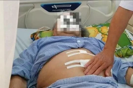 Phòng ngừa, điều trị thoát vị khe hoành sớm, tránh biến chứng nguy hiểm