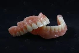 Gắp dị vật răng giả thành công, tránh nguy hiểm cho bệnh nhân