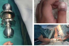 Bé 5 tuổi mắc kẹt ngón tay vào ổ khóa, thoát hiểm ngoạn mục