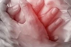 Phẫu thuật thành công cho nam bệnh nhân 44 tuổi bị nhồi máu cơ tim cấp