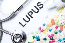 Sốt kéo dài không đáp ứng điều trị, dấu hiệu cảnh báo bệnh tự miễn hiếm gặp