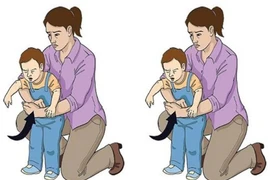 Phẫu thuật thành công lấy dị vật đường thở cho bé trai 4 tuổi