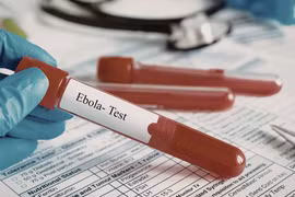 TP HCM siết giám sát cửa khẩu để ngăn nguy cơ dịch xâm nhập dịch dịch Ebola