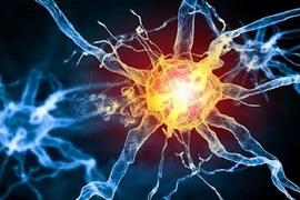 Phương pháp thay huyết tương giúp bệnh nhân viêm đa rễ thần kinh phục hồi 