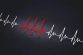 Xác định, xử lý nhịp nhanh kịch phát trên thất trong cấp cứu