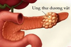 Xu hướng trẻ hóa ung thư dương vật gây lo ngại ở nam giới Việt Nam